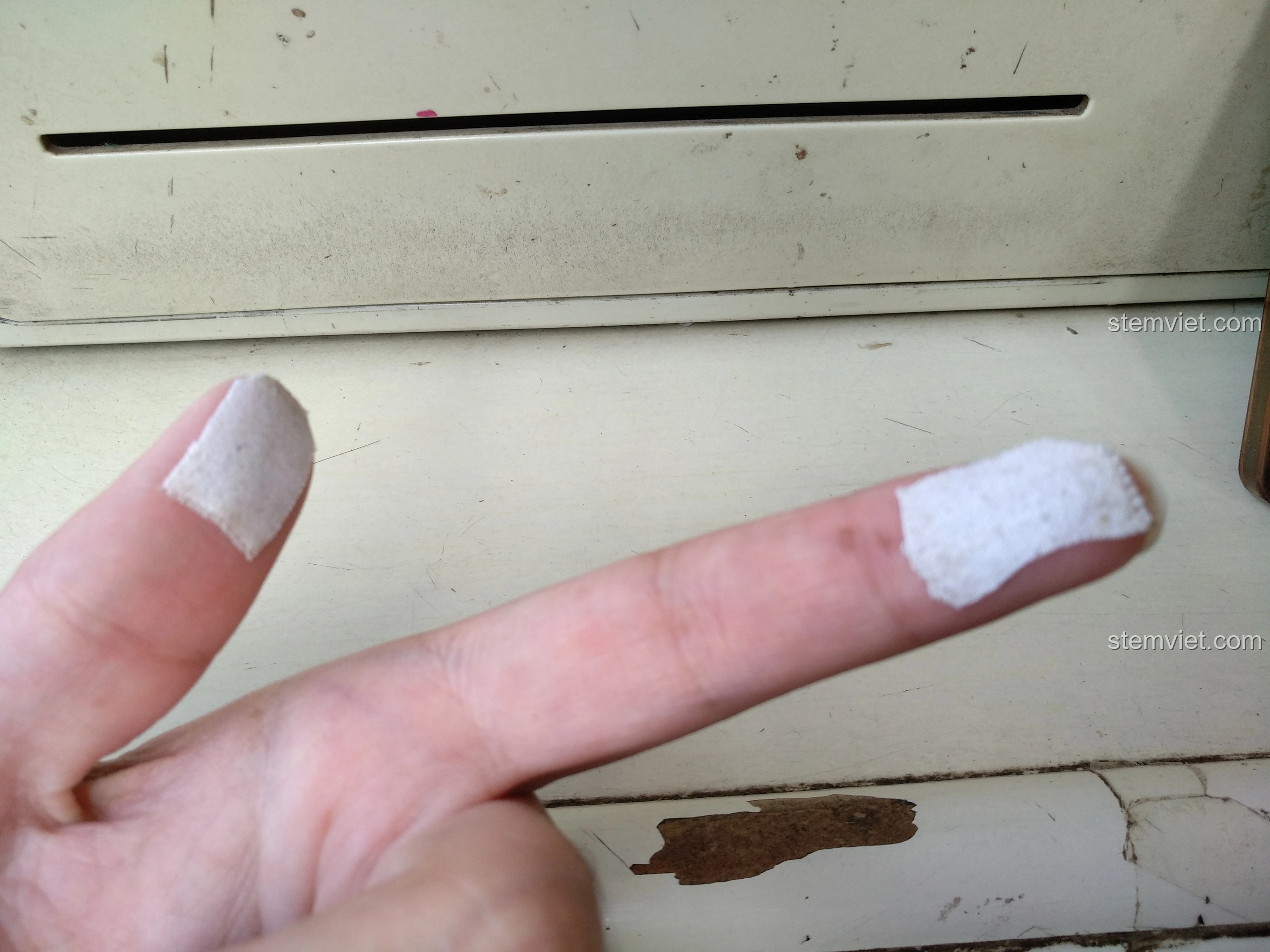 Ngón tay được băng bó sau khi lắp ráp nhiều mảnh lớn của bộ Tàu Đổ Bộ Đệm Khí XINGBAO XB-06019, minh họa độ khó của quá trình.